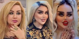 “Eu fiz 43 procedimentos estéticos para me tornar uma Barbie – mas os críticos dizem que eu pareço um ‘zumbi’”