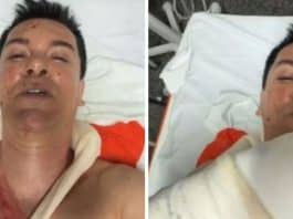 Cantor Regis Danese passa por cirurgia de emergência após ter órgão perfurado em acidente