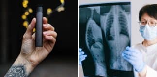 Especialistas explicam o que acontece com seu corpo quando você desiste de vaporizar – fumar cigarros eletrônicos