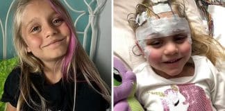 Garota de sete anos é diagnosticada com demência após exame de rotina