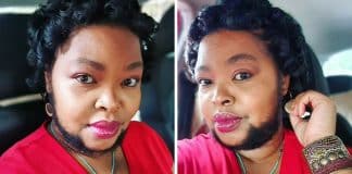 Mulher com crescimento excessivo de pelos desabafa que as pessoas a olham com nojo, mas que ela merece respeito