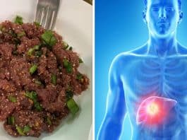 Uma única mordida em prato tailandês pode causar câncer de fígado