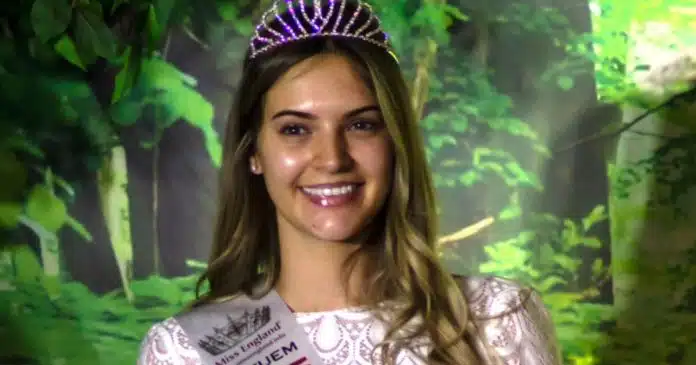 dentista-de-26-anos-vence-o-1-concurso-de-beleza-sem-maquiagem (2) Dentista de 26 anos vence o 1° concurso de beleza sem maquiagem