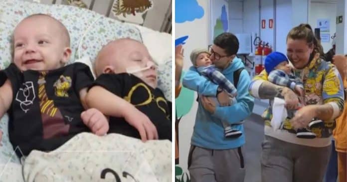Gêmeos siameses que foram abandonados em hospital passam por cirurgia e encontram um lar