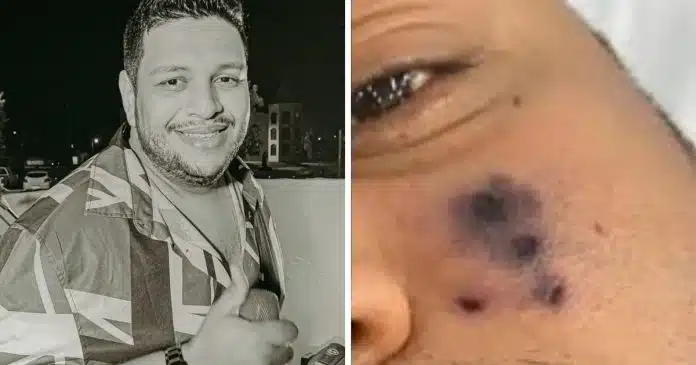 morre-cantor-de-28-anos-apos-ser-picado-por-aranha-no-rosto Morre cantor de 28 anos após ser picado por aranha no rosto: “Começou a escurecer”