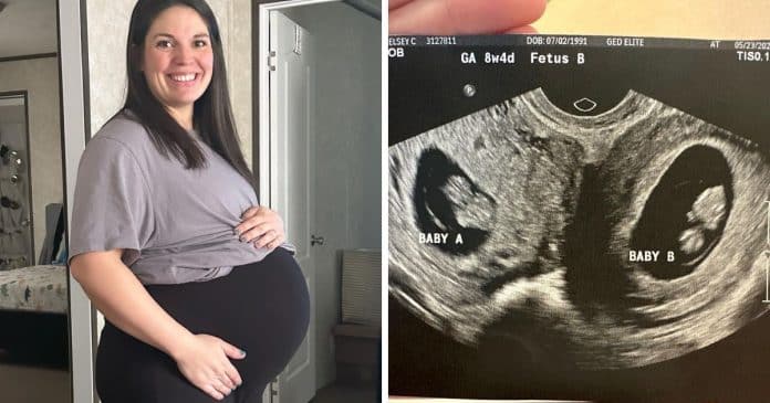 Mulher nasceu com 2 úteros e agora está grávida de ambos – é uma probabilidade de 1 em 50 milhões