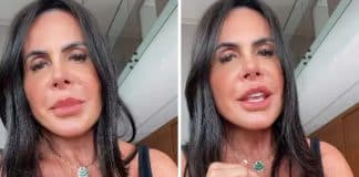 Gretchen revela nova aparência após procedimento estético: “Mais fino e delicado”