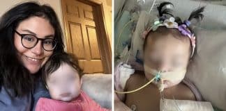 Mãe alerta pais sobre perigo de baterias ‘moeda’ depois que filha de 9 meses teve a garganta queimada