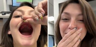 Jovem que usava dentadura comove internautas ao mostrar processo incrível de obtenção de ‘dentes novos’