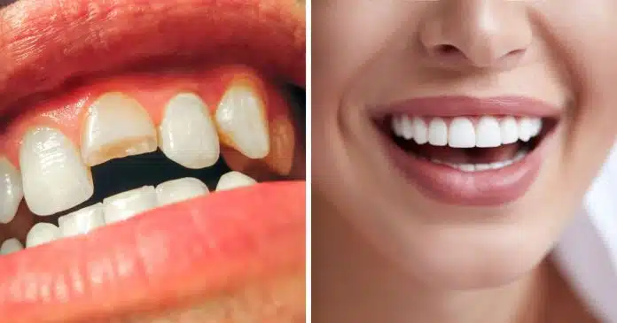 evolucao-primeiro-medicamento-mundo-para-regenerar-dentes-e-aprovado-para-testes-em-humanos EVOLUÇÃO: Primeiro medicamento mundo para “crescer” dentes perdidos é aprovado para testes em humanos