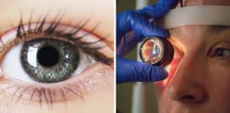 Cientistas revelam que existe uma nova cor de olhos rara: Apenas 1% da população possui