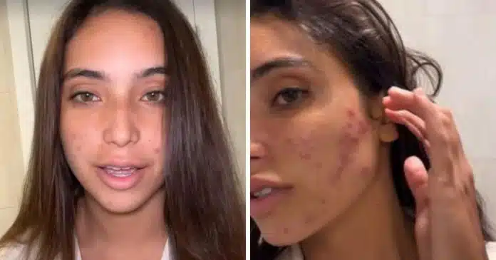 de-cara-limpa-vanessa-lopes-surpreende-seguidores-ao-mostrar-o-verdadeiro-estado-do-rosto De cara limpa, Vanessa Lopes surpreende seguidores ao mostrar o verdadeiro estado do rosto