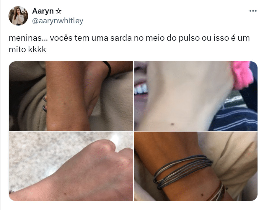 sabiaspalavras.com - A Internet est&aacute; pirando porque as pessoas parecem ter uma pinta EXATAMENTE no mesmo lugar