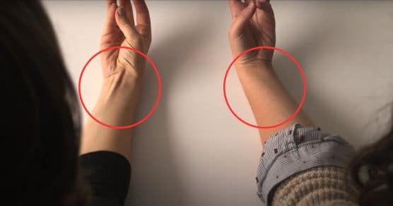 Se o seu tendão levanta quando você toca o dedo mindinho com o polegar, é isso o que significa