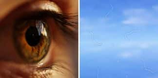 Especialista explica o que é e o que você deve começar a ver “moscas volantes” nos seus olhos