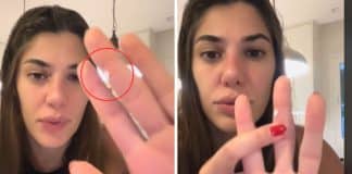 Estudante gera confusão ao afirmar que acredita ter contraído HPV ao tocar em objeto na academia