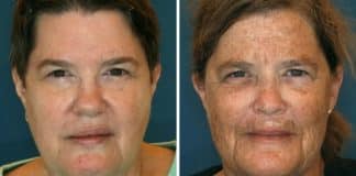 Estudo surpreende ao revelar por que essas gêmeas de 61 anos parecem ter idades drasticamente diferentes