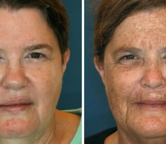 Estudo surpreende ao revelar por que essas gêmeas de 61 anos parecem ter idades drasticamente diferentes