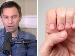 Médico revela sinal claro nas unhas que pode dizer ‘quanto tempo’ uma pessoa tem de vida