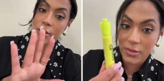 Mulher com câncer de cólon alerta 5 sinais que ignorou pensando que era só “o sutiã estava muito apertado”