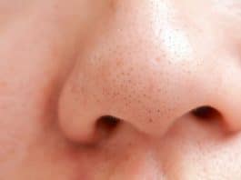 Surpreendente como muitas pessoas ainda acham que isso é um cravo