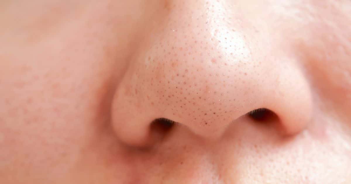 Surpreendente como muitas pessoas ainda acham que isso é um cravo