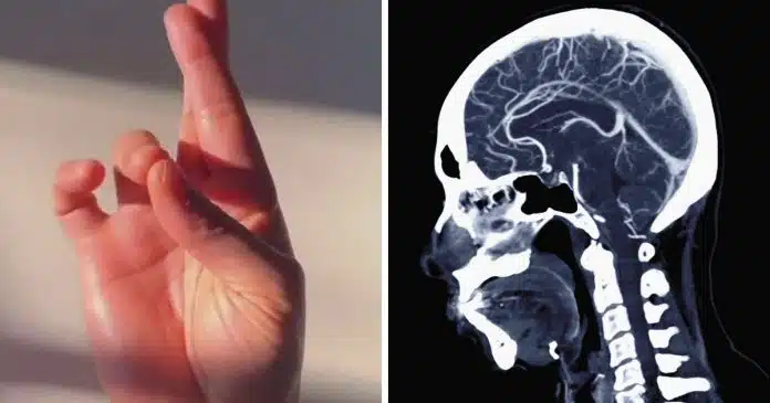 teste-de-7-segundos-que-afirma-detectar-alzheimer-ou-avc-viraliza-nas-redes-sociais Teste de 7 segundos que afirma detectar Alzheimer ou AVC viraliza nas redes sociais