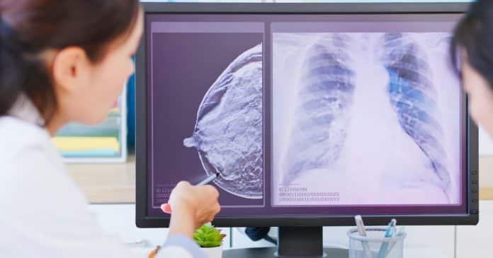cientistas-alertam-que-deixar-de-usar-estes-produtos-de-beleza-pode-desativar-genes-do-cancer-de-mama-em-apenas-28-dias Cientistas alertam que deixar de usar estes produtos de beleza pode ‘desativar genes do câncer de mama’ em apenas 28 dias