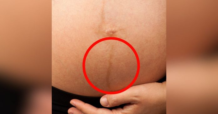 pessoas-ficam-boquiabertas-ao-descobrir-o-que-e-realmente-uma-linha-escura-e-tenue-que-pode-aparecer-em-sua-barriga Pessoas ficam boquiabertas ao descobrir o que é realmente uma linha escura e tênue que pode aparecer em sua barriga