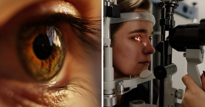 detalhe-sutil-em-seus-olhos-pode-ser-um-alerta-precoce-para-demencia Detalhe sutil em seus olhos pode ser um alerta para demência já aos 40 anos