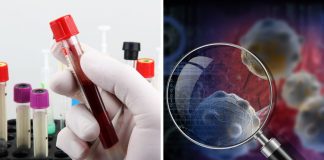 Médicos identificam o tipo sanguíneo com maior risco de desenvolver esse tipo de câncer