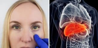 Especialistam alertam que suplementos podem estar destruindo seu fígado – Um aviso preocupante sobre os “Remédios Naturais”