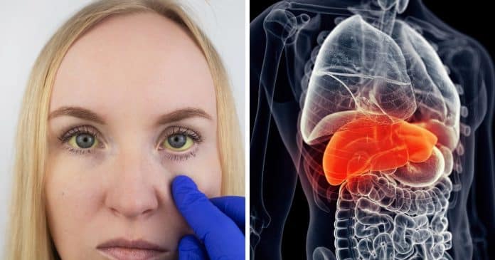 especialistam-alertam-que-suplementos-podem-estar-destruindo-seu-figado-um-aviso-preocupante-sobre-os-remedios-naturais Especialistam alertam que suplementos podem estar destruindo seu fígado – Um aviso preocupante sobre os “Remédios Naturais”