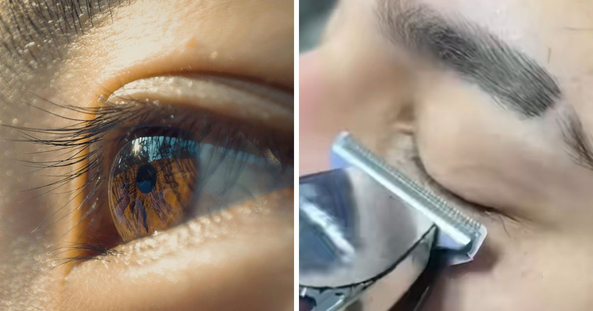 Especialistas alertam para os perigos da nova tendência entre os homens em ‘raspar os cílios’