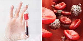 Este simples exame de sangue pode ajudar a detectar 14 tipos de câncer