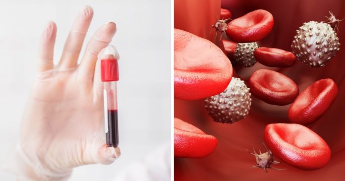 este-simples-exame-de-sangue-pode-ajudar-a-detectar-14-tipos-de-cancer Este simples exame de sangue pode ajudar a detectar 14 tipos de câncer