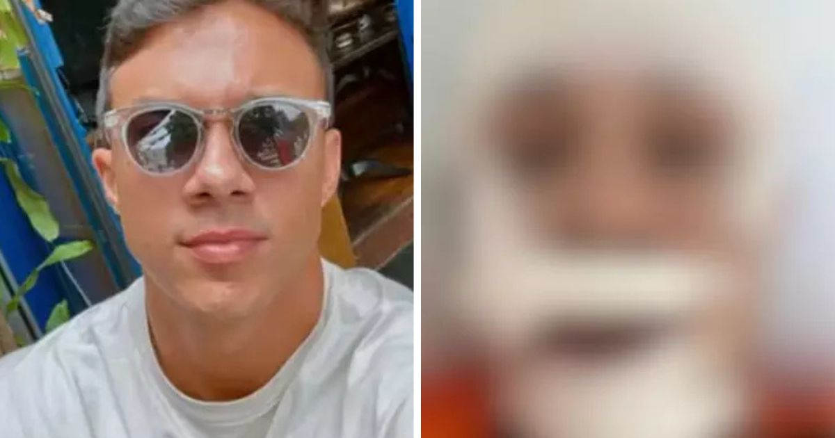 Personal trainer é agredido e leva 45 pontos no rosto ao defender mulheres de assédio em bar no interior de SP
