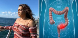 Por que o número de casos de câncer como o que matou Preta Gil cresce ‘assustadoramente’ em pessoas com menos de 50 anos