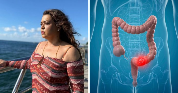 Por que o número de casos de câncer como o que matou Preta Gil cresce ‘assustadoramente’ em pessoas com menos de 50 anos
