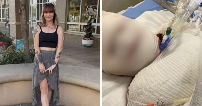 Após o parto, mãe toma medicamento comum e 95% da pele do seu corpo SE SOLTA: Ela lutou pela vida