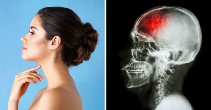 a-circunferencia-do-pescoco-pode-indicar-risco-de-infarto-e-avc-segundo-estudos A sua circunferência do pescoço pode indicar risco de infarto e AVC, segundo estudos