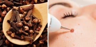 Como usar cravo-da-índia para tratar verrugas e pólipos de pele de forma natural