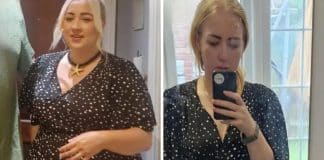 “Perdi 38 quilos tomando Mounjaro — agora me sinto nojenta quando olho para meu corpo”