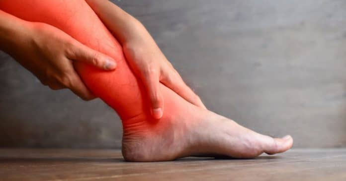 4-sintomas-nas-pernas-podem-ser-sinais-de-cancer-letal-muito-perigoso-e-pouco-detectado 4 Sintomas nas pernas podem ser sinais de ‘câncer letal’ muito perigoso e pouco detectado