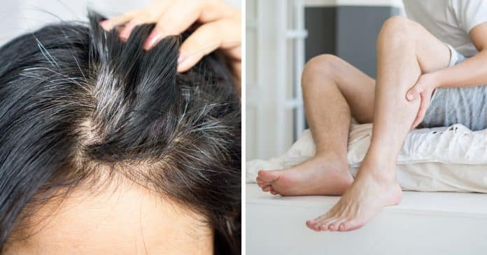 como-saber-se-o-seu-corpo-esta-com-falta-de-nutrientes-sinais-que-voce-nao-deve-ignorar Como saber se o seu corpo está com falta de nutrientes: Sinais que você não deve ignorar