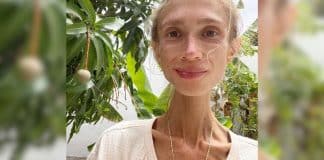 Mulher de 27 anos morre de fome em quarto de hotel após seguir dieta experimental ‘frutariana’