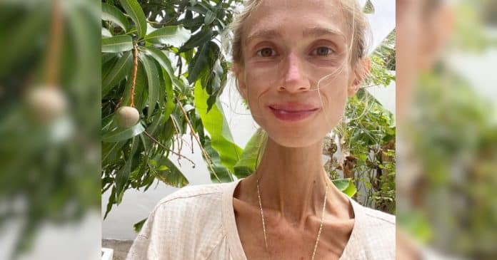 Mulher de 27 anos morre de fome em quarto de hotel após seguir dieta experimental ‘frutariana’