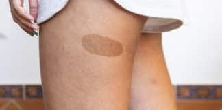 Sua marca de nascença pode revelar como você morreu em uma vida passada? Entenda o que diz a espiritualidade Sua marca de nascença pode revelar como você morreu em uma vida passada? Entenda o que diz a espiritualidade