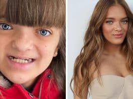 A surpreendente jornada de Rafaella Justus: da malformação à transformação inspiradora na adolescência