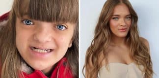 A surpreendente jornada de Rafaella Justus: da malformação à transformação inspiradora na adolescência